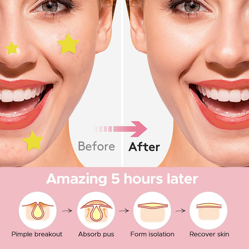 600 adet/takım yıldız sivilce  - Beauty With Makeup incelemesi ve fiyatı